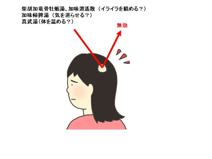 円形脱毛症　病院